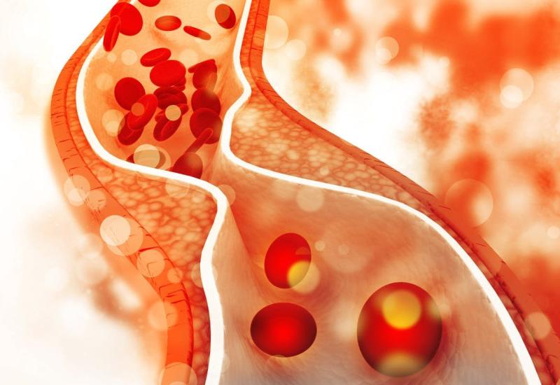 Infosessie Cholesterol © google